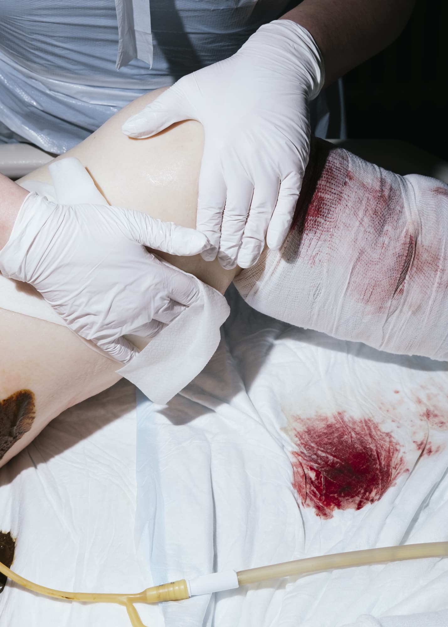 Nicht muede werden —  Hand detail of nurse washing blood and excrements off a patient's leg